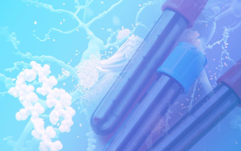 Blood Test To Predict Alzheimer s 94 Accurate PEPID Pulse